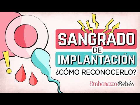 ¿Cómo saber si es falsa regla? Descubre aquí los mejores consejos