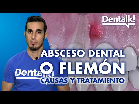 Remedios caseros para bajar un flemón
