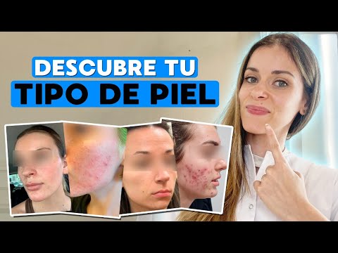 ¿Piel grasa o seca? Descubre cómo saberlo