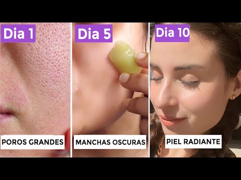 Elimina puntos negros de la cara de forma casera