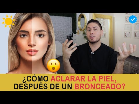 Consejos para quitar lo quemado del sol: El mejor cuidado para tu piel