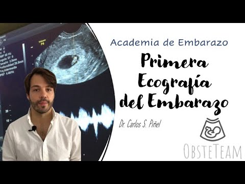 La primera ecografía de embarazo: así se ve y qué esperar