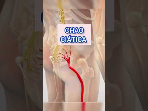 Trucos para dormir y desinflamar el nervio ciático