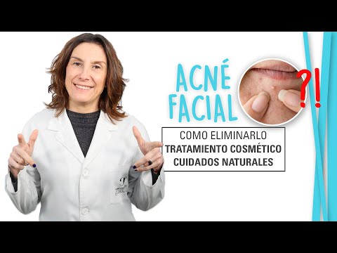 Elimina los granos de la cara con estos consejos efectivos