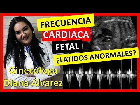 Escucha el corazón del bebé: Cómo hacerlo correctamente
