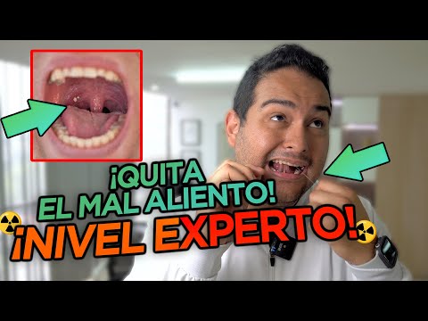 5 consejos efectivos para quitar el mal olor de una muela picada