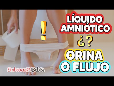 ¿Cómo saber si pierdo líquido amniótico? Guía completa y práctica
