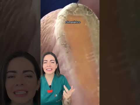 Quitar durezas de los pies con bicarbonato: método efectivo