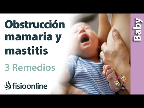 Eliminar bolas en los senos durante la lactancia: cómo hacerlo