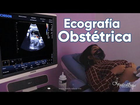 Guía completa: Cómo entender un ultrasonido de embarazo