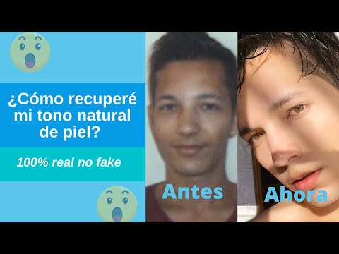 Descubre cómo aclarar el tono de piel de forma efectiva