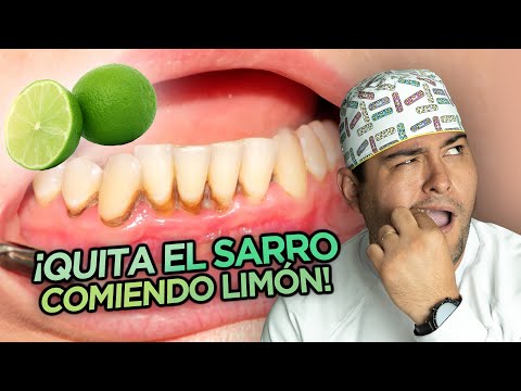 Elimina el sarro de los dientes de forma natural: trucos efectivos