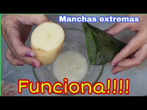 Elimina manchas de granos: trucos para quitarlas fácilmente