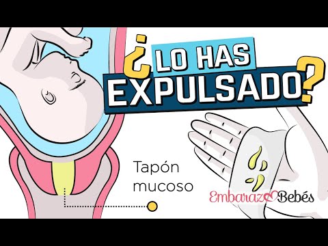 Tapon mucoso en el parto: todo lo que debes saber
