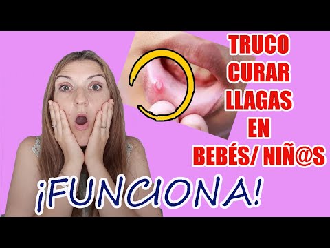 Guía práctica: Cómo curar llagas en la boca de niños