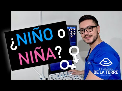 Descubre cómo se ve el ultrasonido cuando es niña: Guía completa