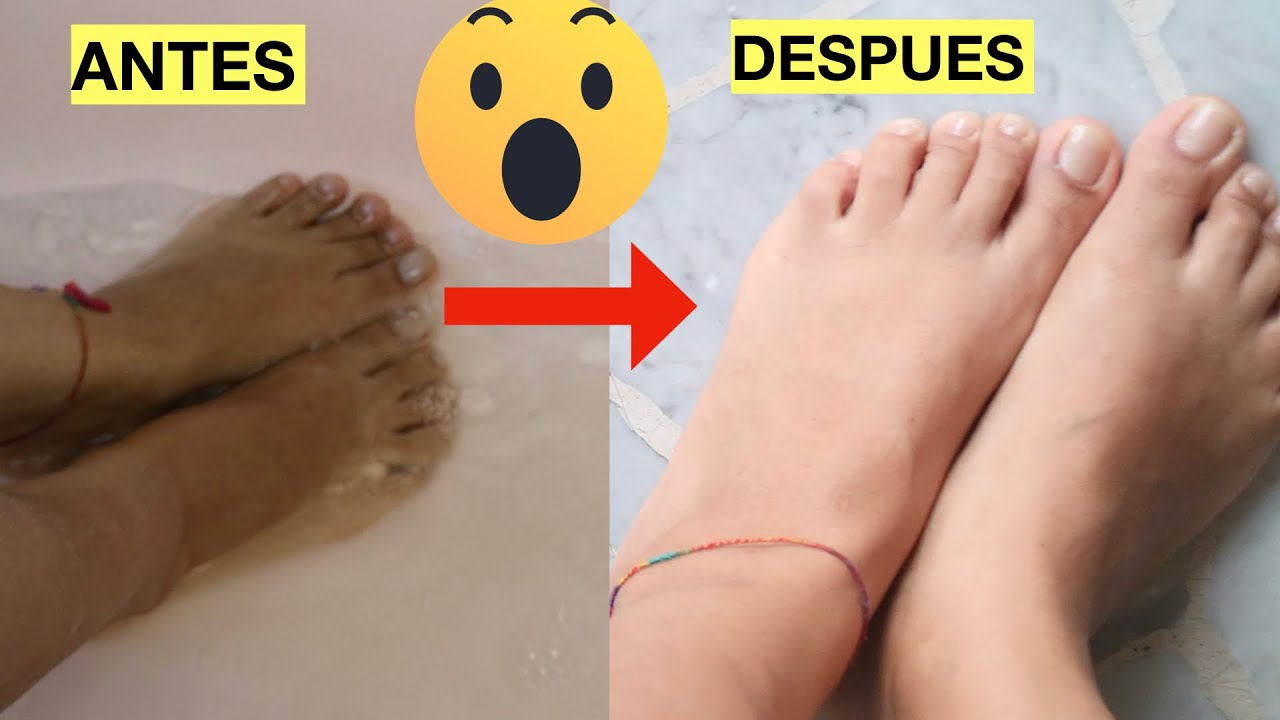 como aclarar los pies en minutos