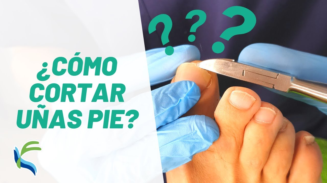 como arreglar las unas delos pies