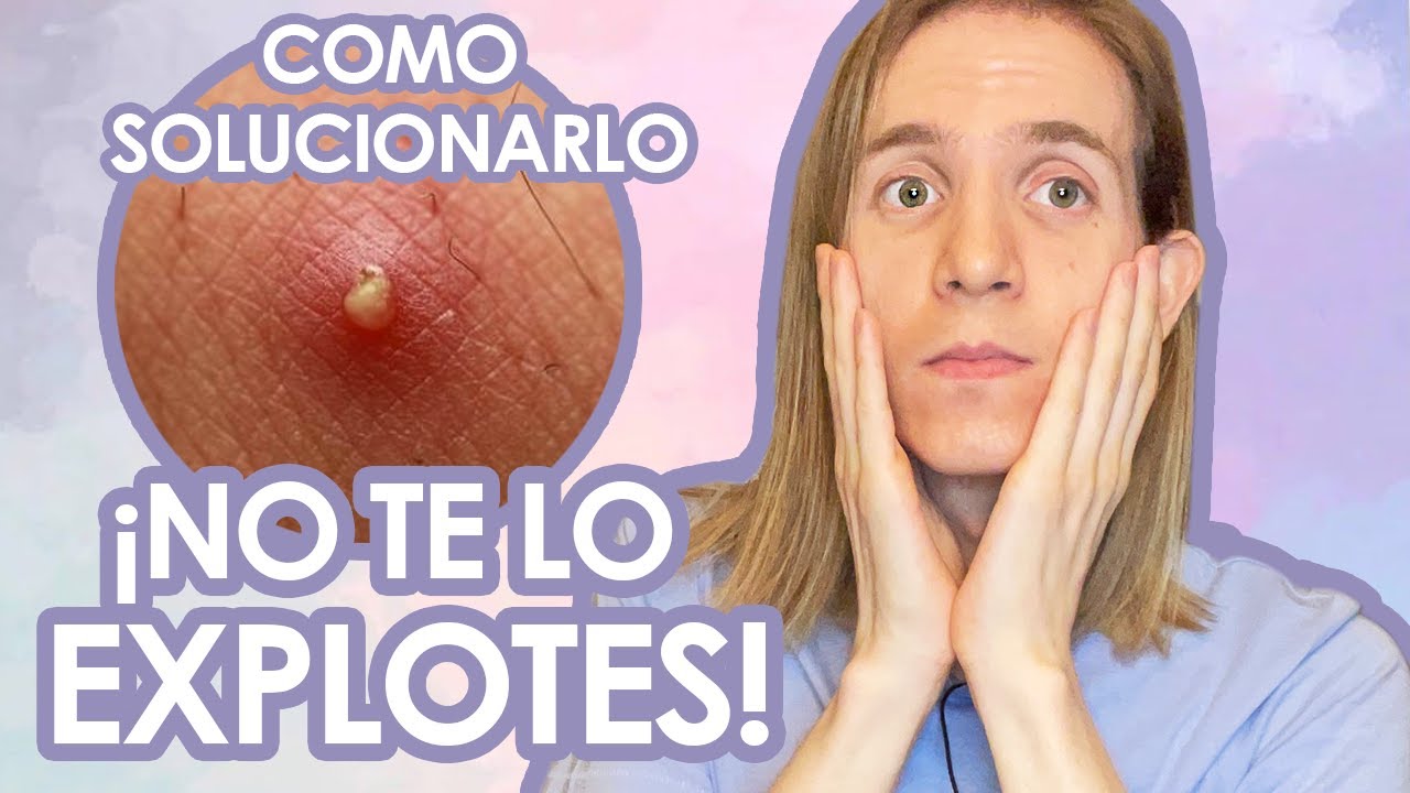 como hacer que cicatrice un grano