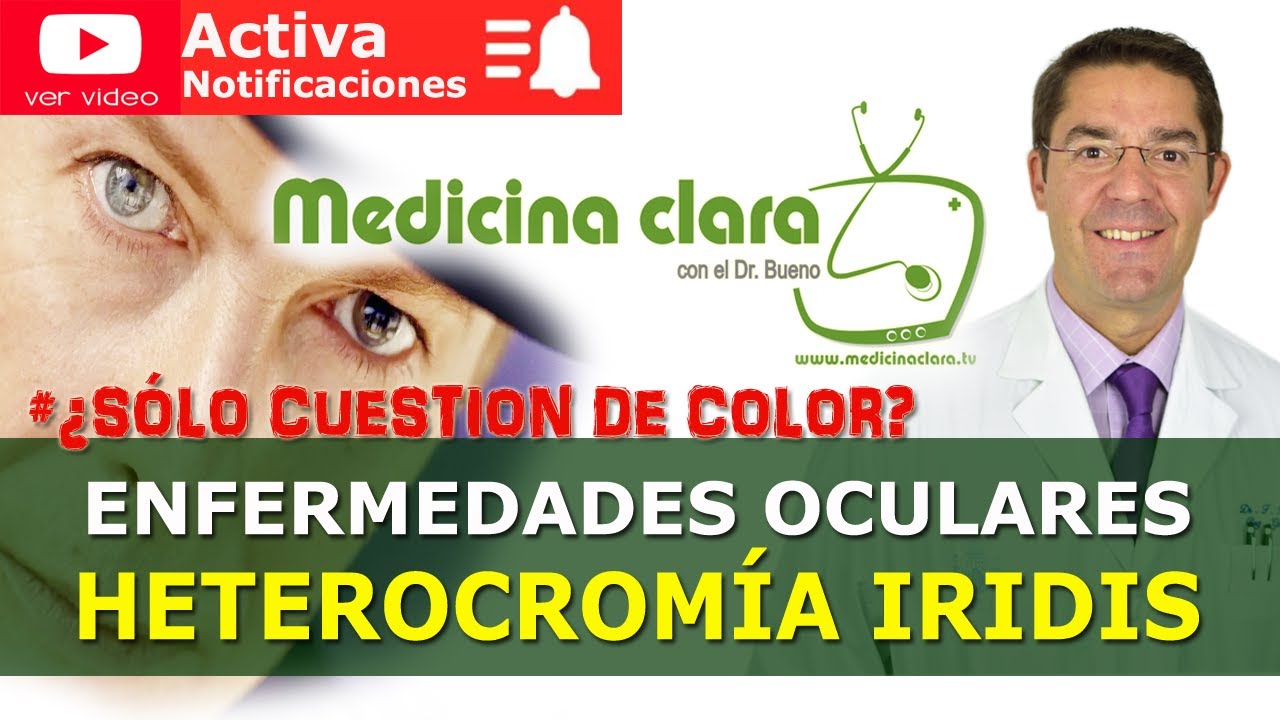 como se llama cuando tienes un ojo de cada color