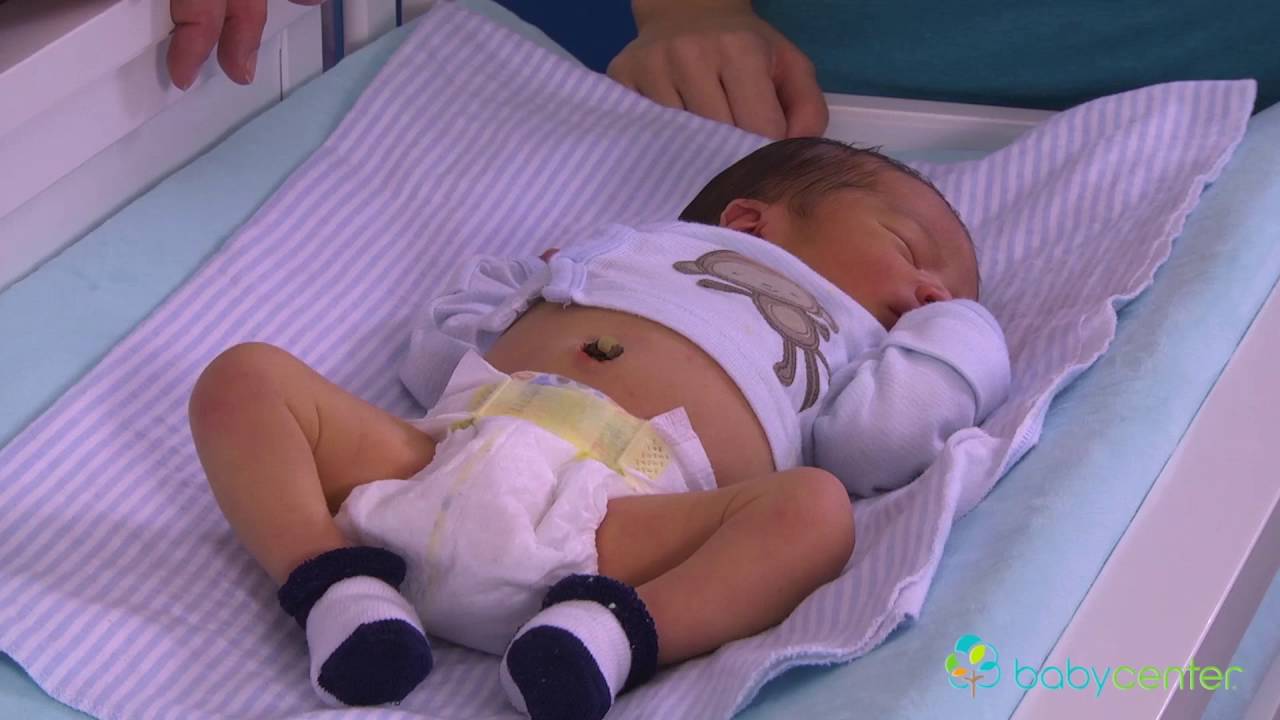 como se queda el ombligo cuando se cae