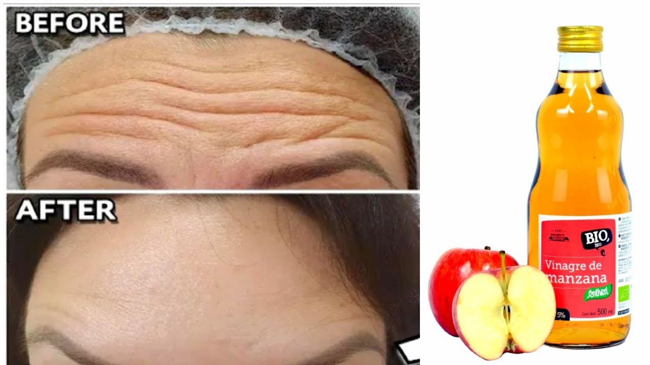 como usar el vinagre de manzana para las arrugas