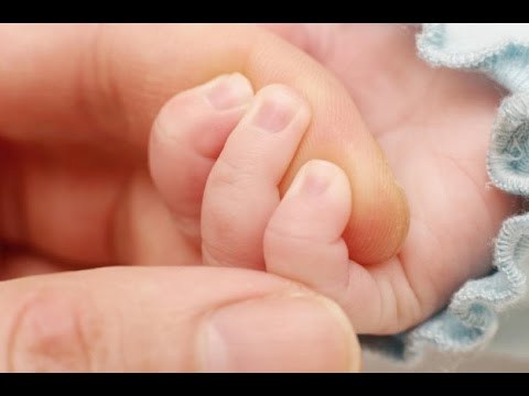 bilirrubina en bebes como se cura