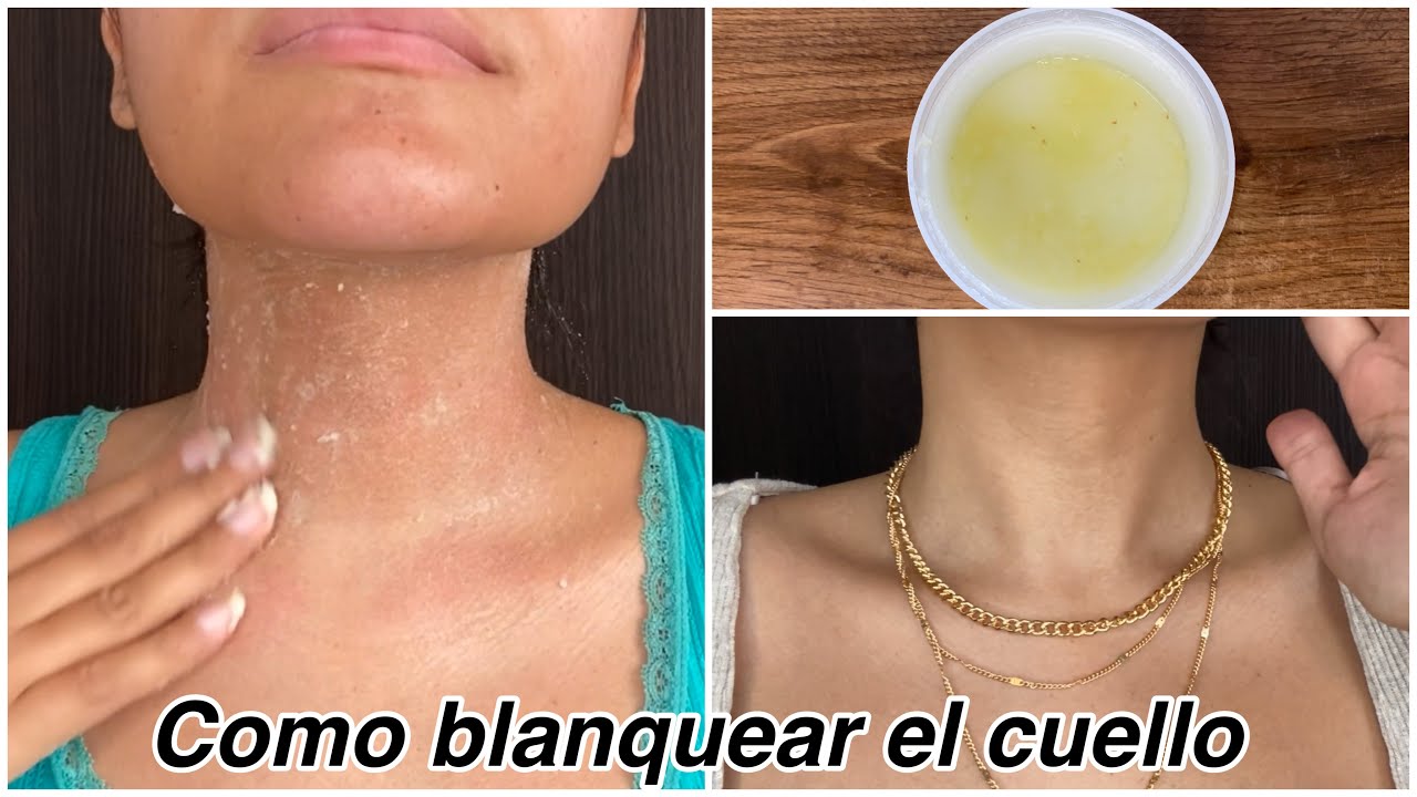 como blanquear el cuello en 20 minutos