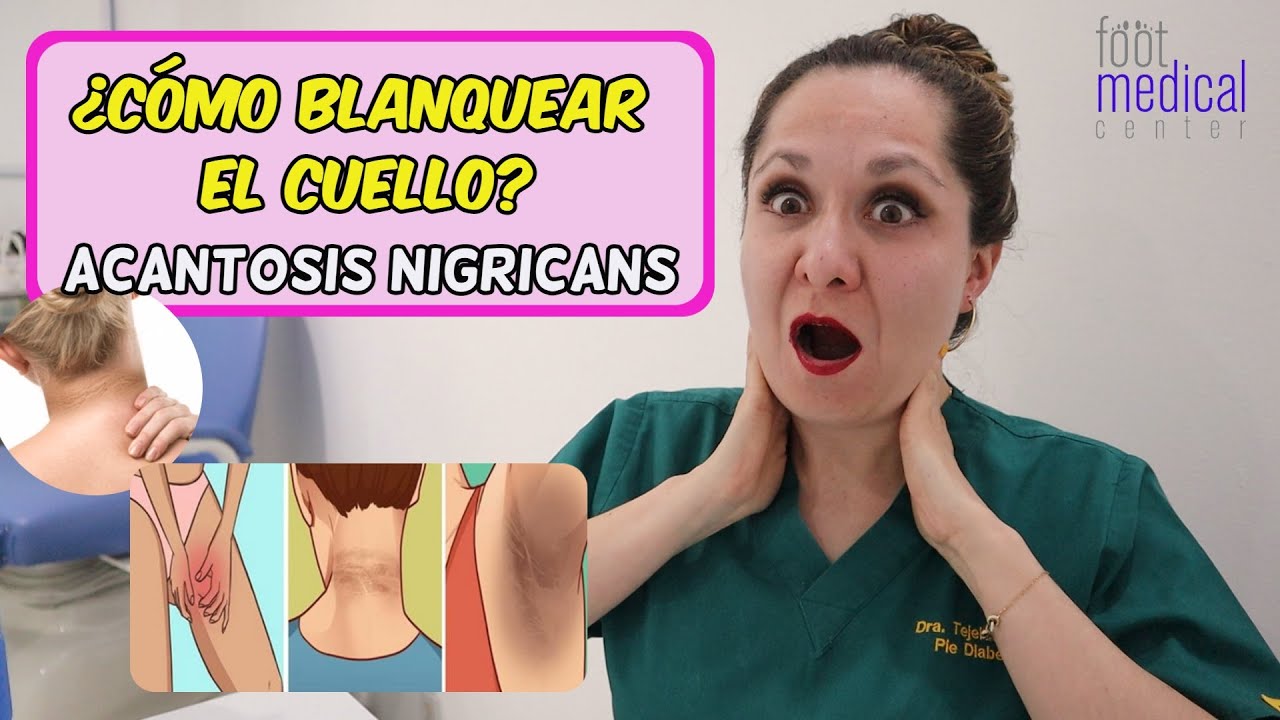 como blanquear el cuello y las axilas