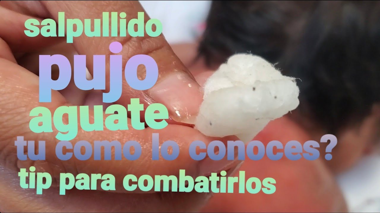 como curar el pujo con leche materna
