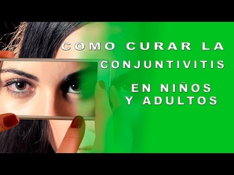 como curar la conjuntivitis en bebes remedios caseros