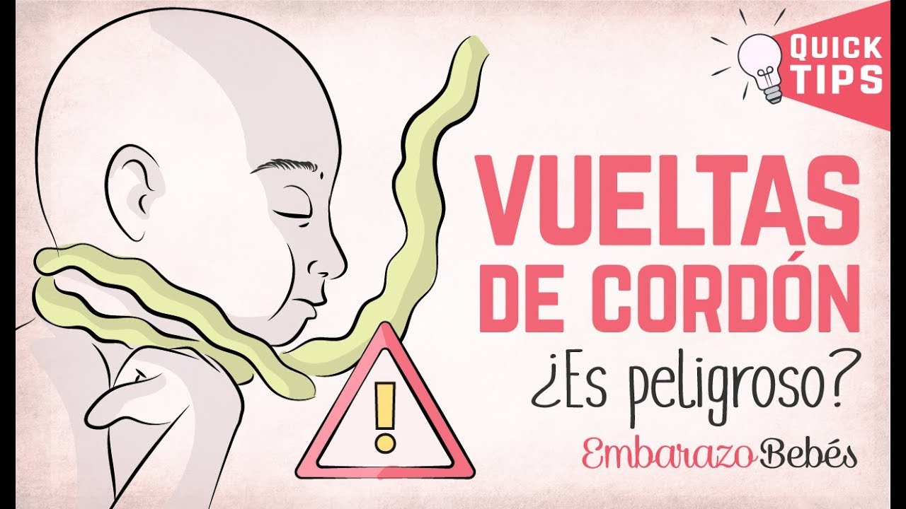 como desenredar el cordon umbilical del cuello del bebe