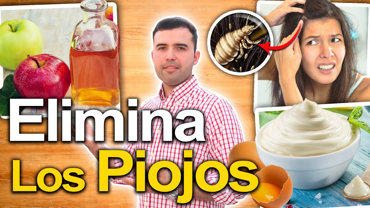 como eliminar los piojos de la cabeza con remedios caseros