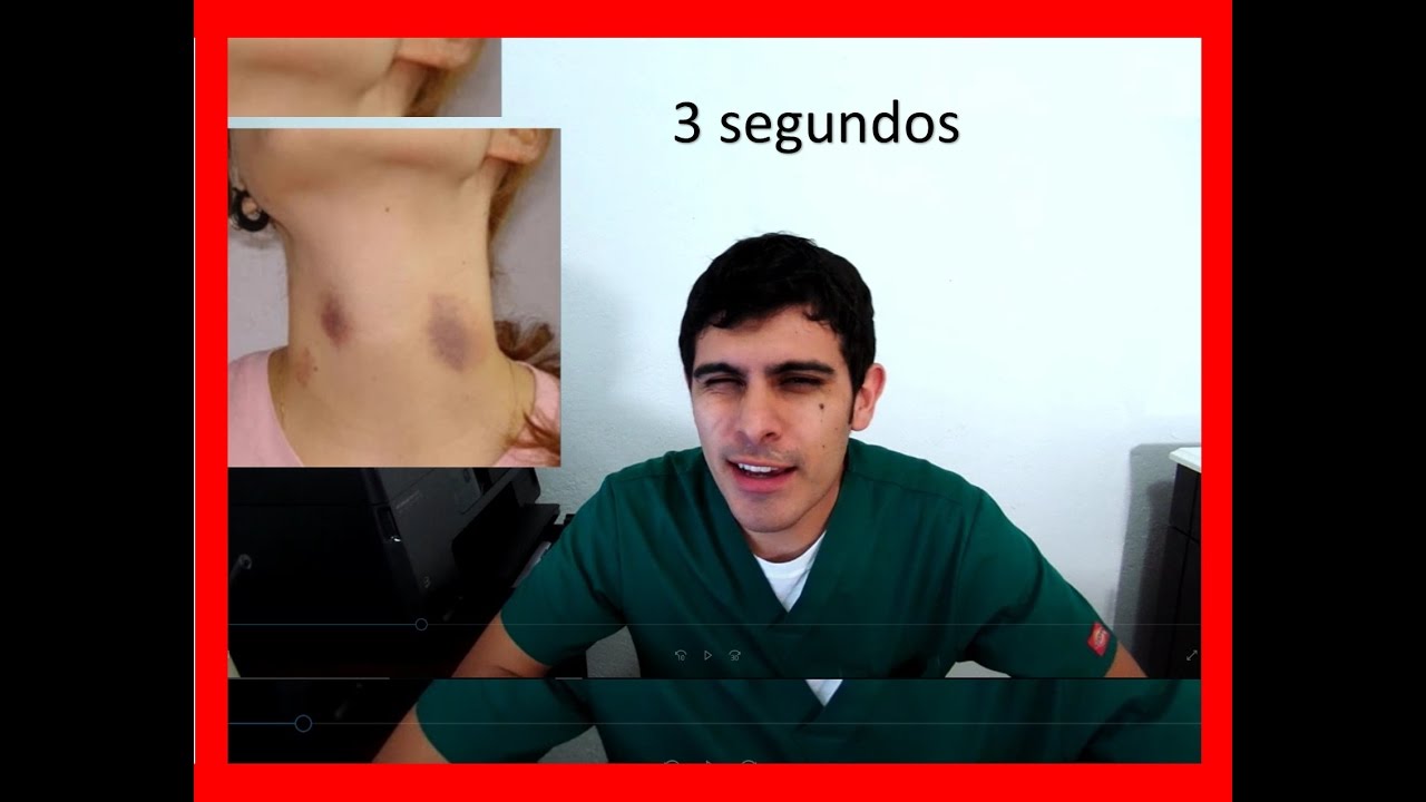 como quitar chupetones con cuchara fria