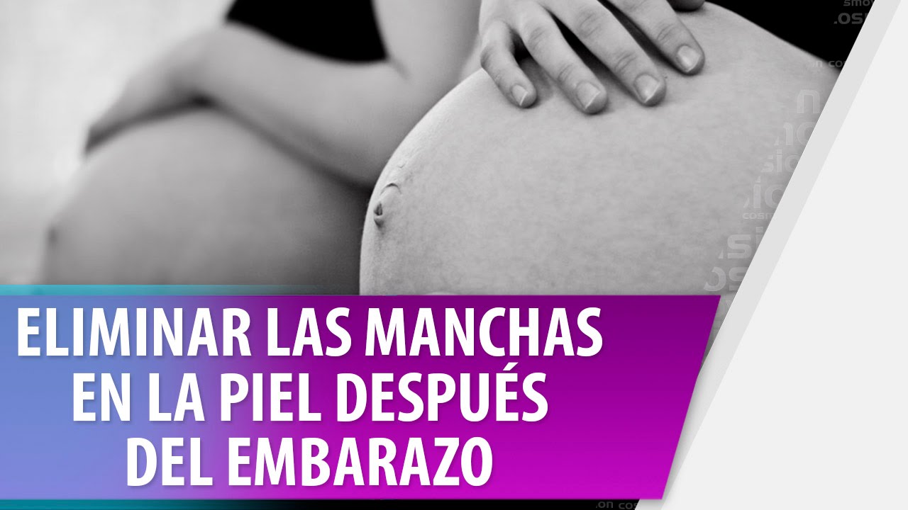 como quitar el pano de la cara por embarazo