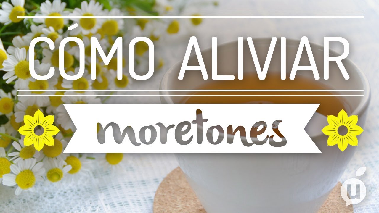 como quitar moretones en un dia