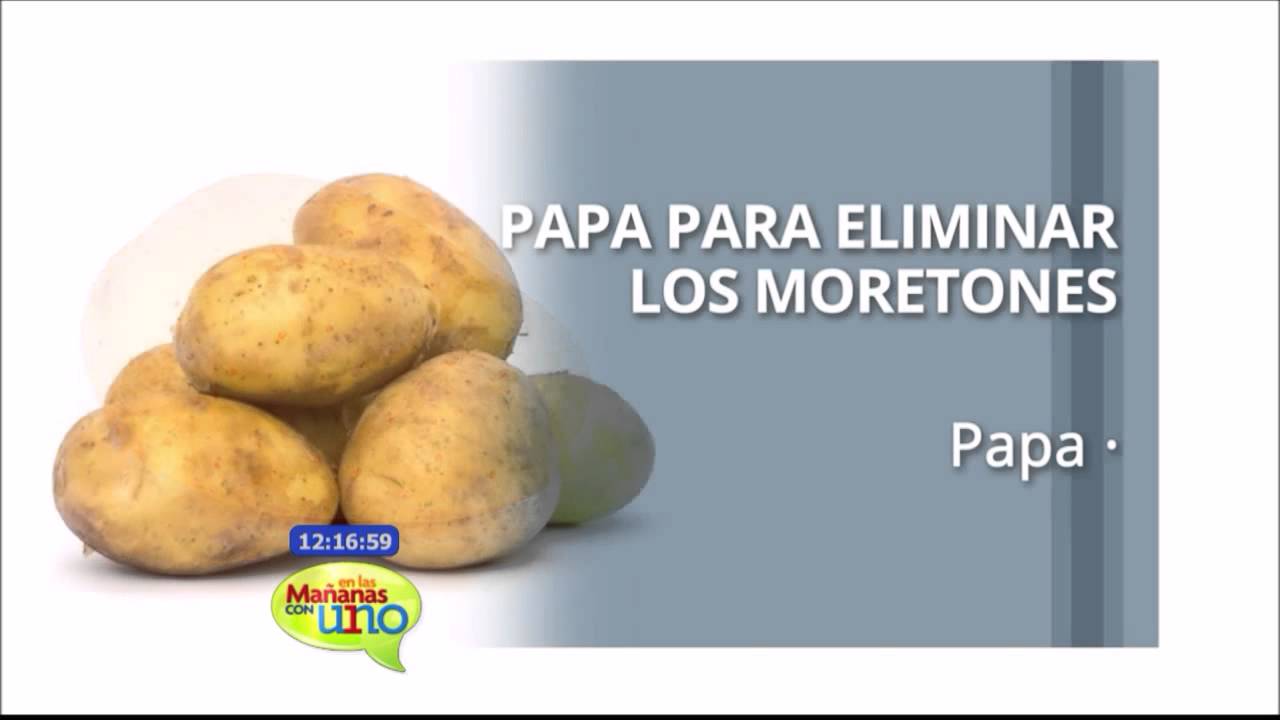 como quitar moretones que ya tienen tiempo