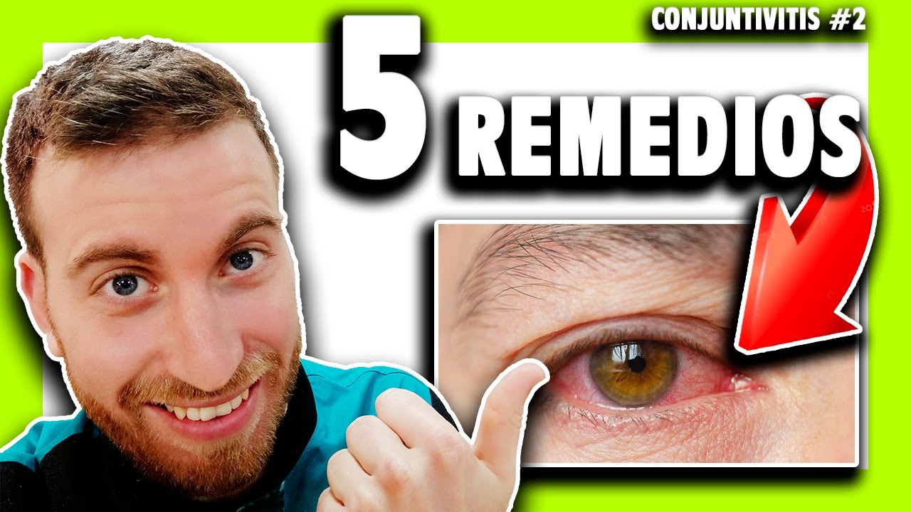 como se cura la conjuntivitis remedios caseros