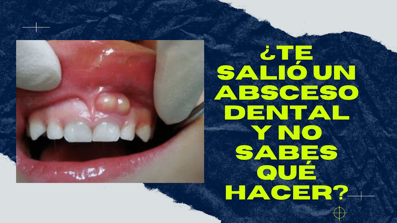 como se puede quitar una postemilla