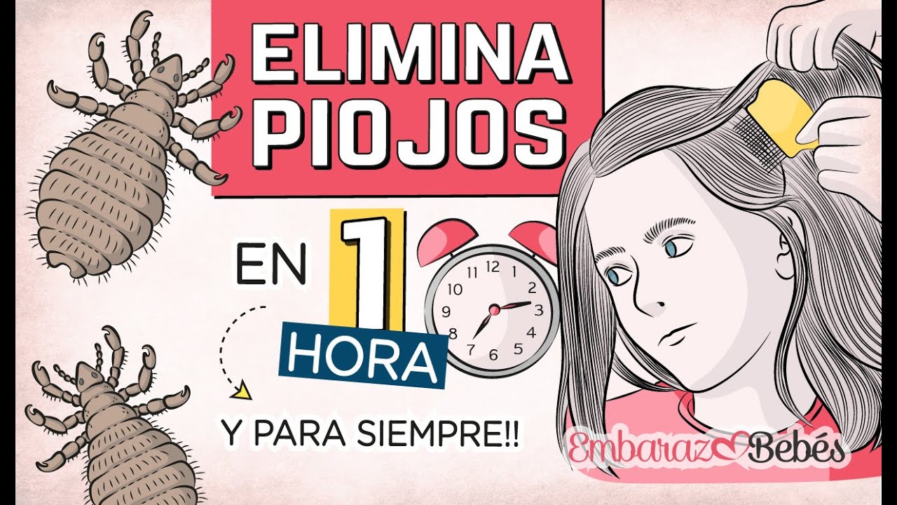 como se quitan los piojos y liendres