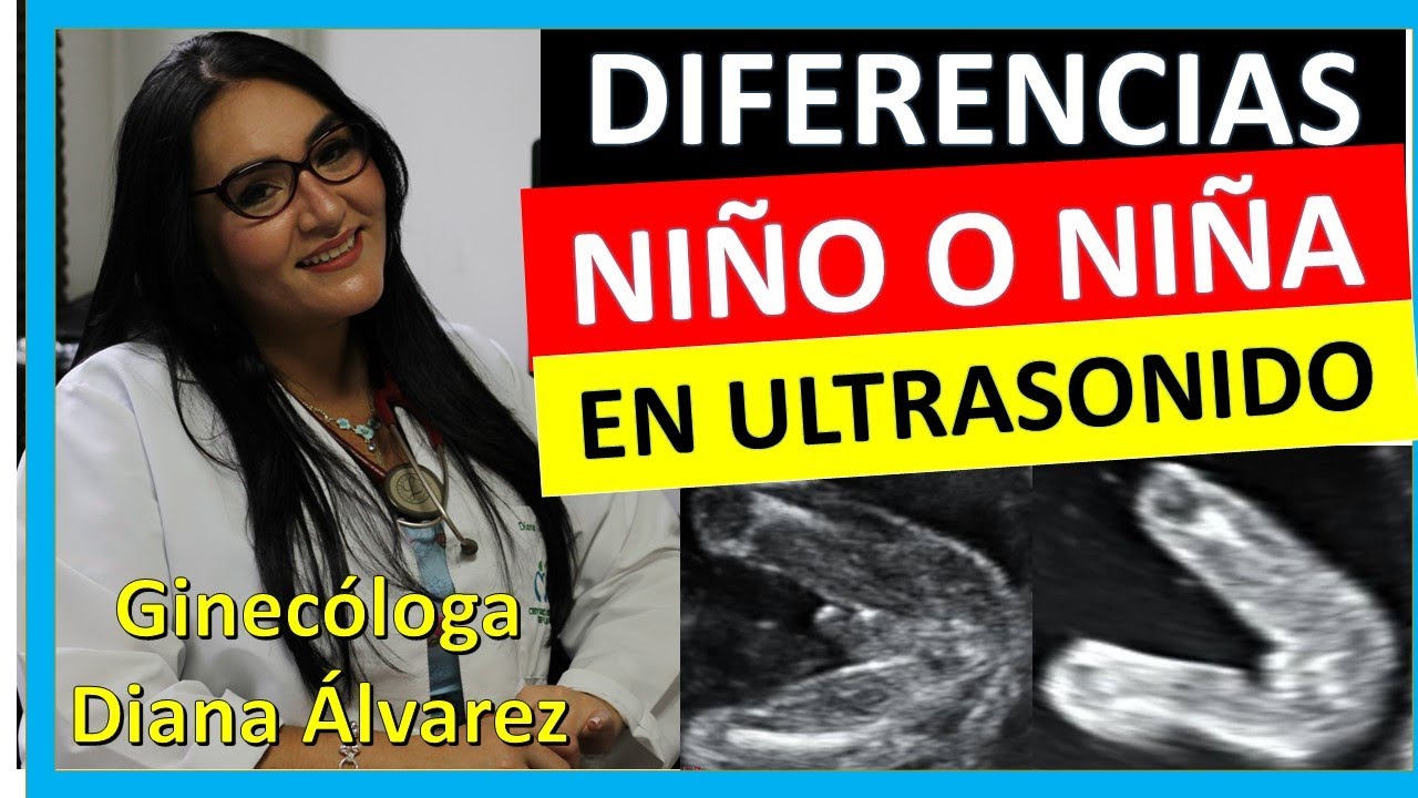 como se ve el ultrasonido de un bebe varon