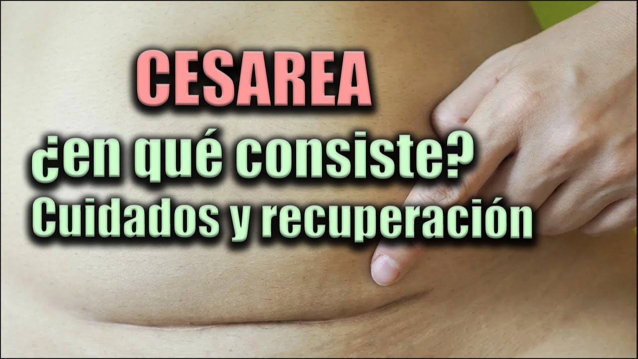 como se ve una cesarea por dentro